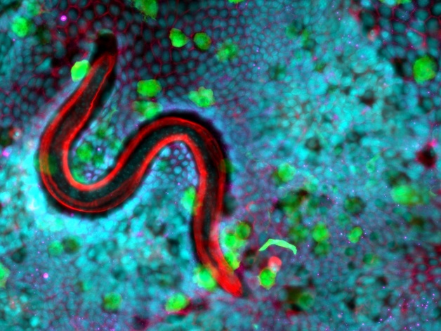 Image of a whipworm infecting mouse caecaloids