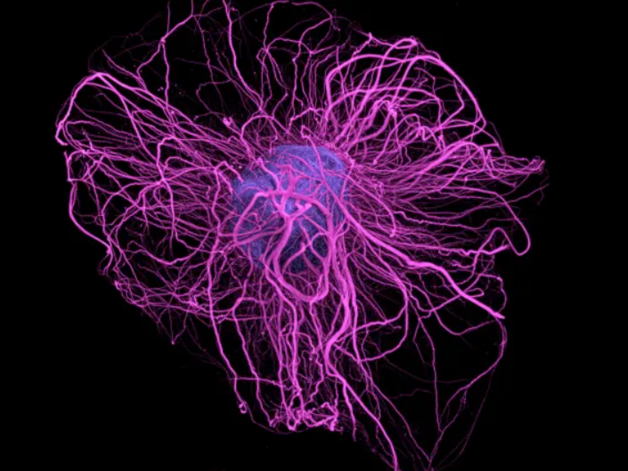 Image of dopamine neuron