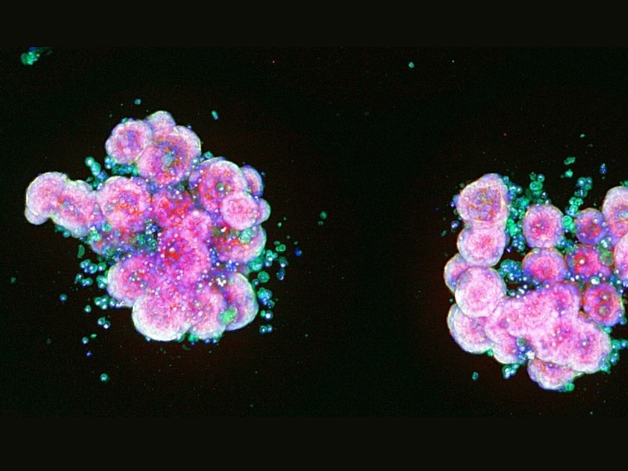 Human intestinal organoid microscopy image