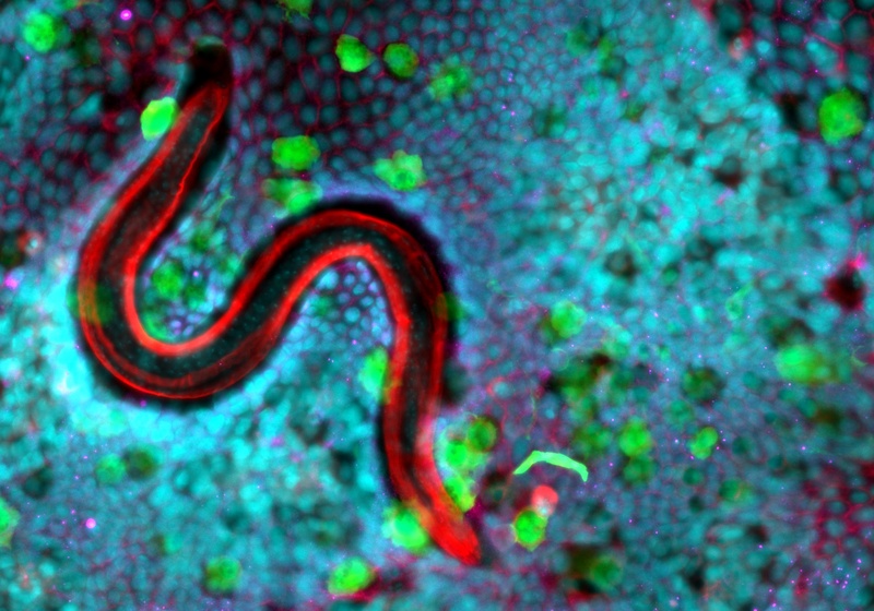 Image of a whipworm infecting mouse caecaloids