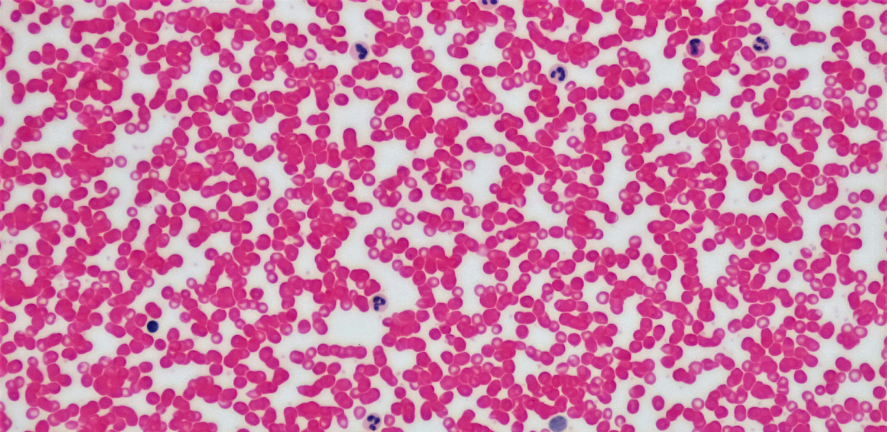 Leukocyte smear