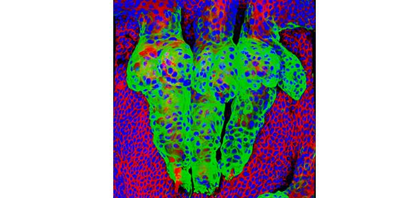 triplet-of-oesophageal-hair-follicles-paula-jimenez-gomez