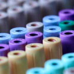 Test tubes