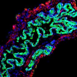 3D cell scaffolding supports future transplant therapies