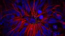 Brain Cells Created from Patient's Skin