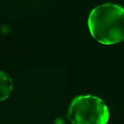 Cambridge discovery paves the way for new diabetes treatment options