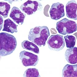 Cambridge scientists granted over £500,000 to search for new cancer treatments