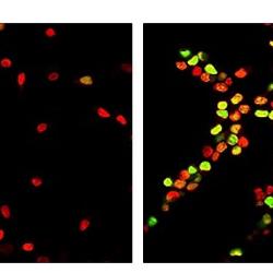 Cambridge scientists reverse ageing process in rat brain stem cells