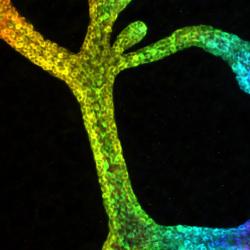Breast cancer scientists use innovative 3D imaging to help track cancer cells