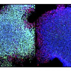 Missing link found between pathways involved in cell development