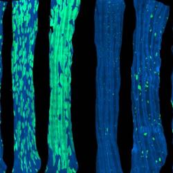 Potentially cancerous cells kept in check by competitive neighbours, study of oesophagus finds