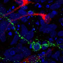 Rising Star: Cambridge Stem Cell Scientist awarded Young Investigator Award