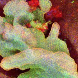 Scientists identify ‘cell of origin’ in skin cancers