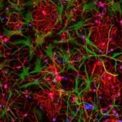 Spotlight on Stem Cells