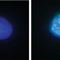 Stem cells and genetics: the ‘perfect storm’ for cancer progression