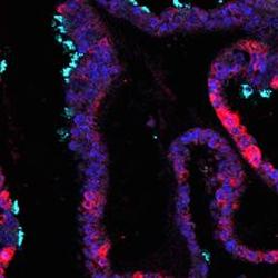 Miniature ‘womb lining’ grown in lab could reveal secrets of menstrual cycle and early pregnancy