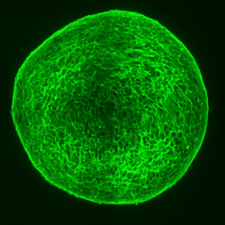 Ball of neuroblastoma cells forming mature nerves after drug treatment (Credit: Kirsty Ferguson/Developmental Cell)