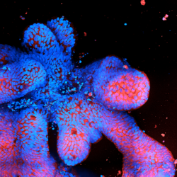  image of a patient derived, human intetstial organoid.