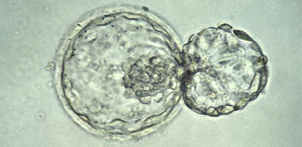 Human blastocyst hatching. K. Hardy. CC BY 4.0. A human embryo at the blastocyst stage, about six days after fertilization, viewed under a light microscope. The embryo is in the process of "hatching" out of the zona pellucida - the tough outer membrane - just before implanting in the wall of the uterus