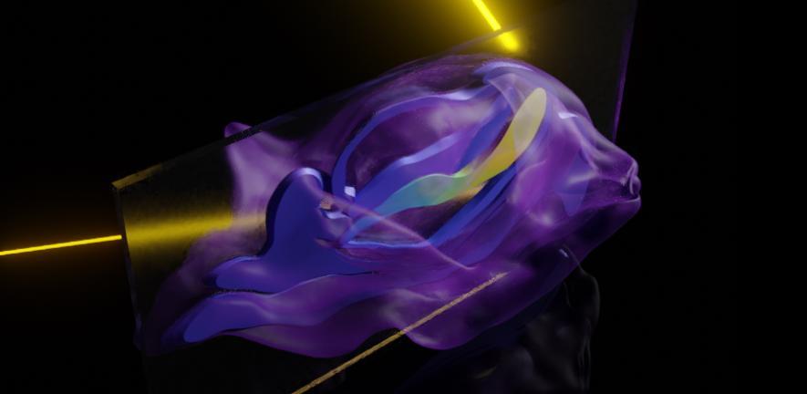Laser assisted analysis of a marmoset embryo after implantation. Image shows gene activity for SOX2, one of the earliest indicators for head formation. Credit U of Cambr Laser assisted analysis of a marmoset embryo after implantation. Image shows gene activity for SOX2, one of the earliest indicators for head formation. Credit U of Cambr