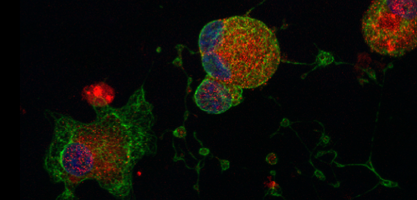 Megakaryocytes produced from human pluripotent stem cells Megakaryocytes produced from human pluripotent stem cells