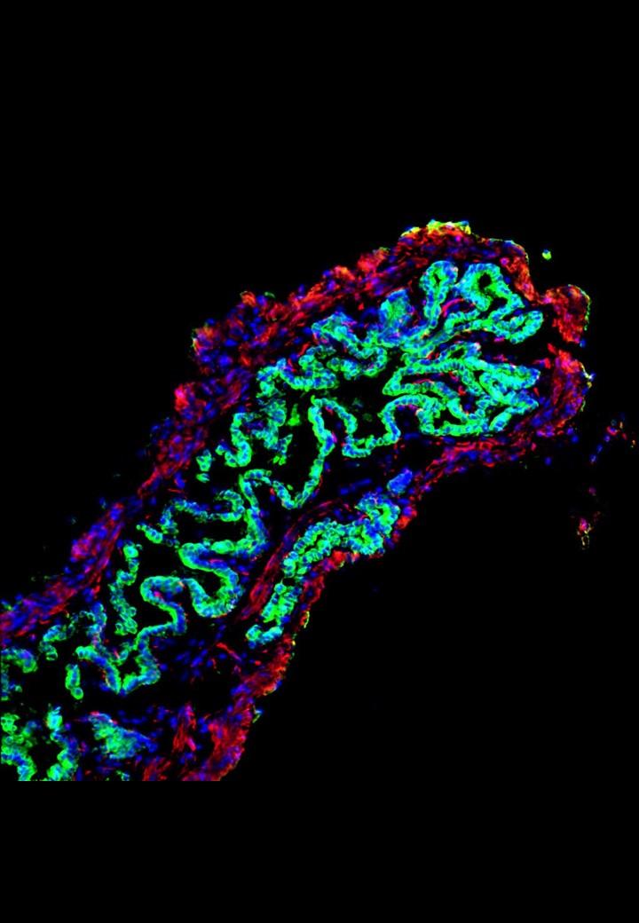 Artificially grown ducts (green) take a tubular shape and can be used in transplantation. 3D cell scaffolding supports future transplant therapies