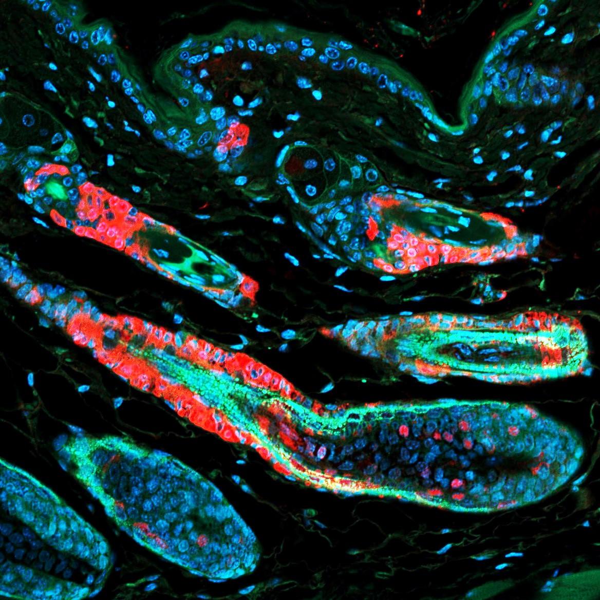 Stem cell function and stress response are controlled by protein synthesis