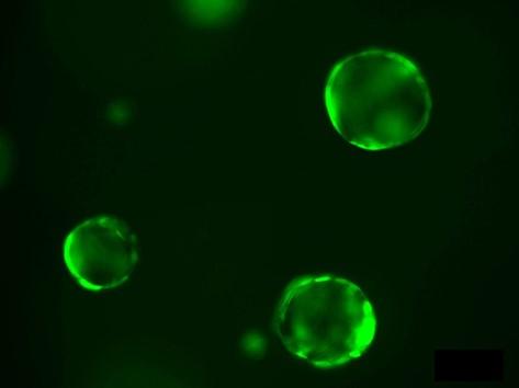 3D clusters of pancreatic cells, called organoids, grown in the Wellcome Trust – MRC Cambridge Stem Cell Institute, are used to study new ways to improve pancreatic function in diabetes. Cambridge discovery paves the way for new diabetes treatment options
