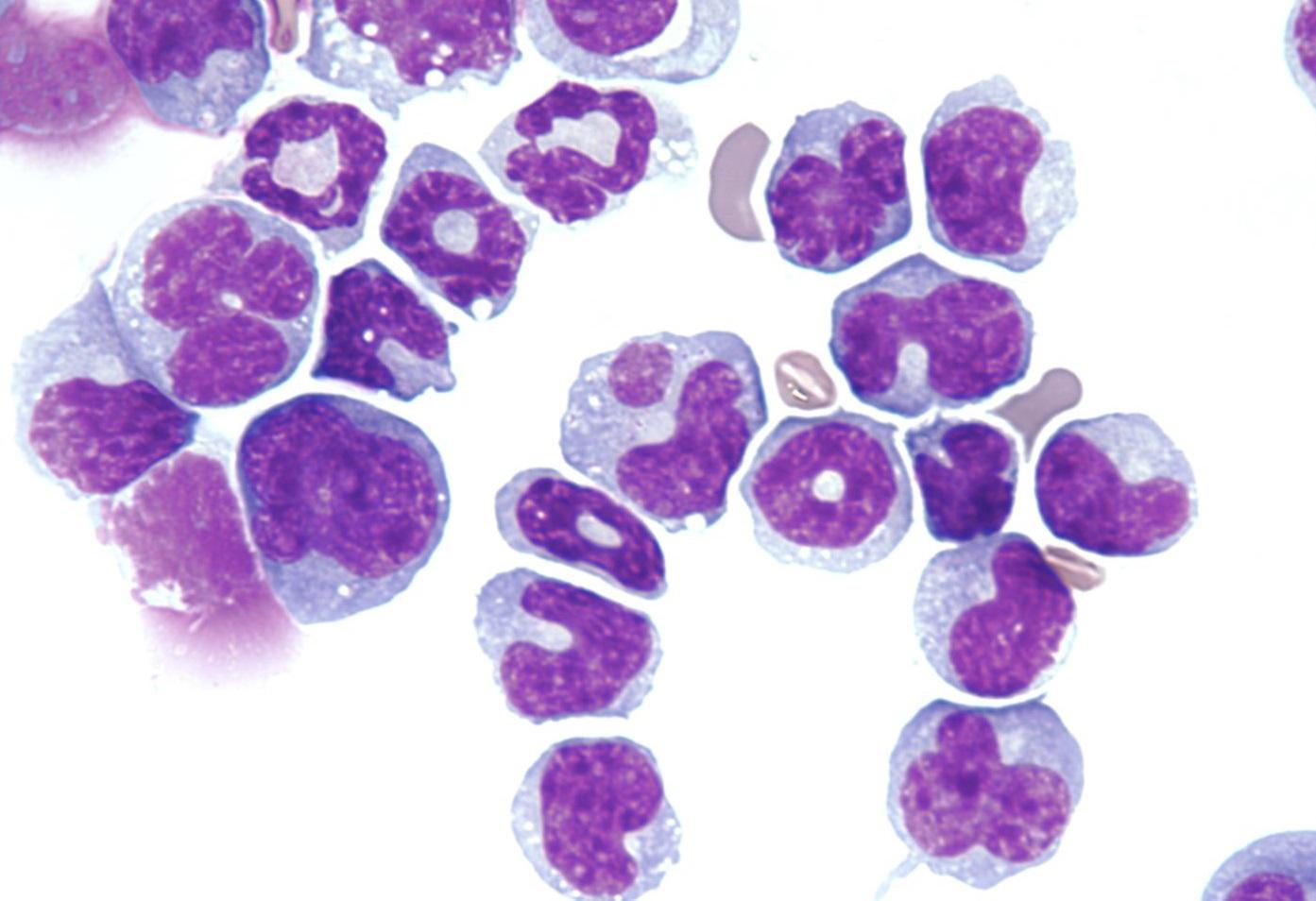 Cambridge scientists granted over £500,000 to search for new cancer treatments