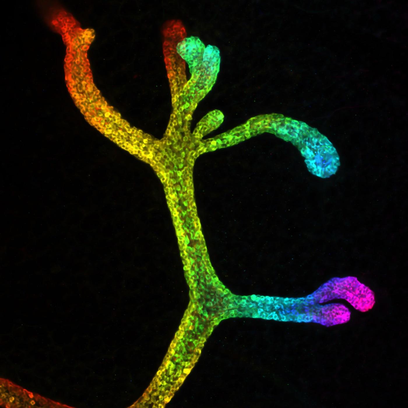 Breast cancer scientists use innovative 3D imaging to help track cancer cells