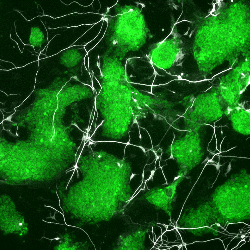 Sall4 controls differentiation of pluripotent cells independently of the NuRD complex