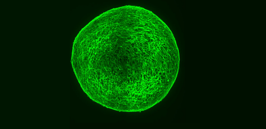 Ball of neuroblastoma cells forming mature nerves after drug treatment (Credit: Kirsty Ferguson/Developmental Cell) Ball of neuroblastoma cells forming mature nerves after drug treatment (Credit: Kirsty Ferguson/Developmental Cell)