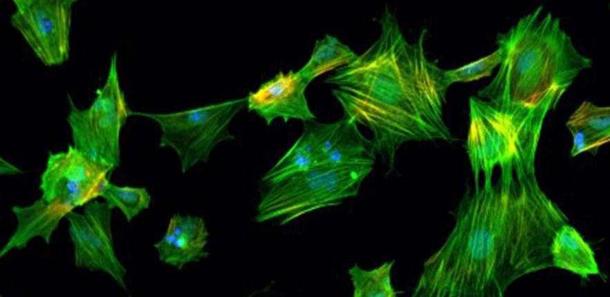 Human Embryonic Stem Cell Derived Smooth Muscle Cells stained for the smooth muscle cell marker transgelin. 
Image Credit: Loukia Yiangou