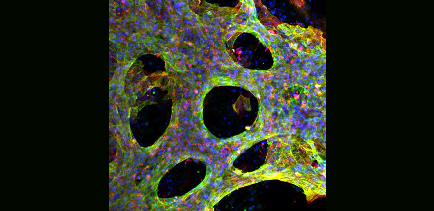 Human Embryonic Stem Cell Derived Cardiomyocytes stained for the cardiomyocytes markers cardiac troponin T (green) and α-actinin (red).
Image Credit: Loukia Yiangou