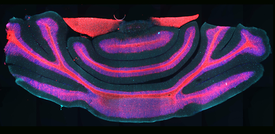 Myelination in the mouse cerebellum, investigated by optogenetic stimulation.
Image by Moritz Matthey