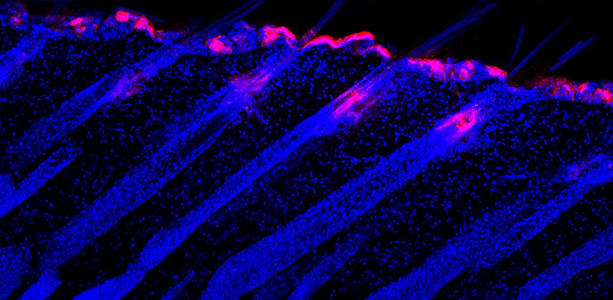 Lineage tracing of hair follicle stem cells following stress exposure. Image Credit: Martyna Popis