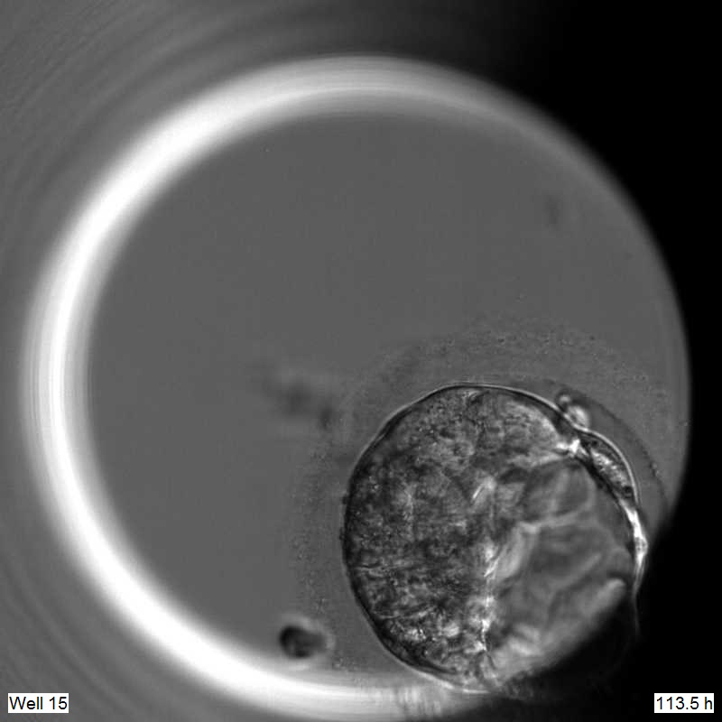 Edited embryo without OCT4 on the fifth day of development. It does not form a proper blastocyst, showing that OCT4 is needed for blastocyst development. Credit: Kathy Niakan