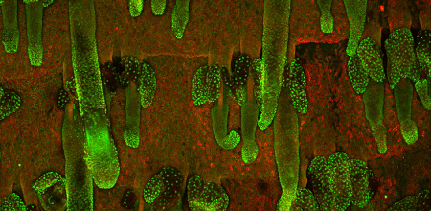 Adult mouse tail epidermal whole-mount labelled with antibodies to keratin 14 (red) and the androgen receptor (green). 

Published as cover of the book Skin and its diseases: a subject from the Cold Spring Harbor perspectives in medicine / edited by Ant