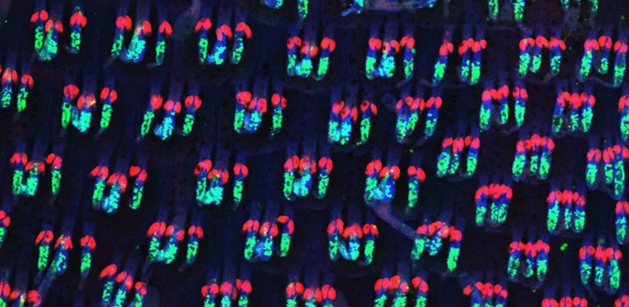 Genetics lineage tracing of BLIMP1-expressing cells and their progeny (labelled with green fluorescent protein, GFP) in a whole-mount preparation of adult mouse tail epidermis. Differentiated sebocytes are labelled in red and polymerized actin is labelled