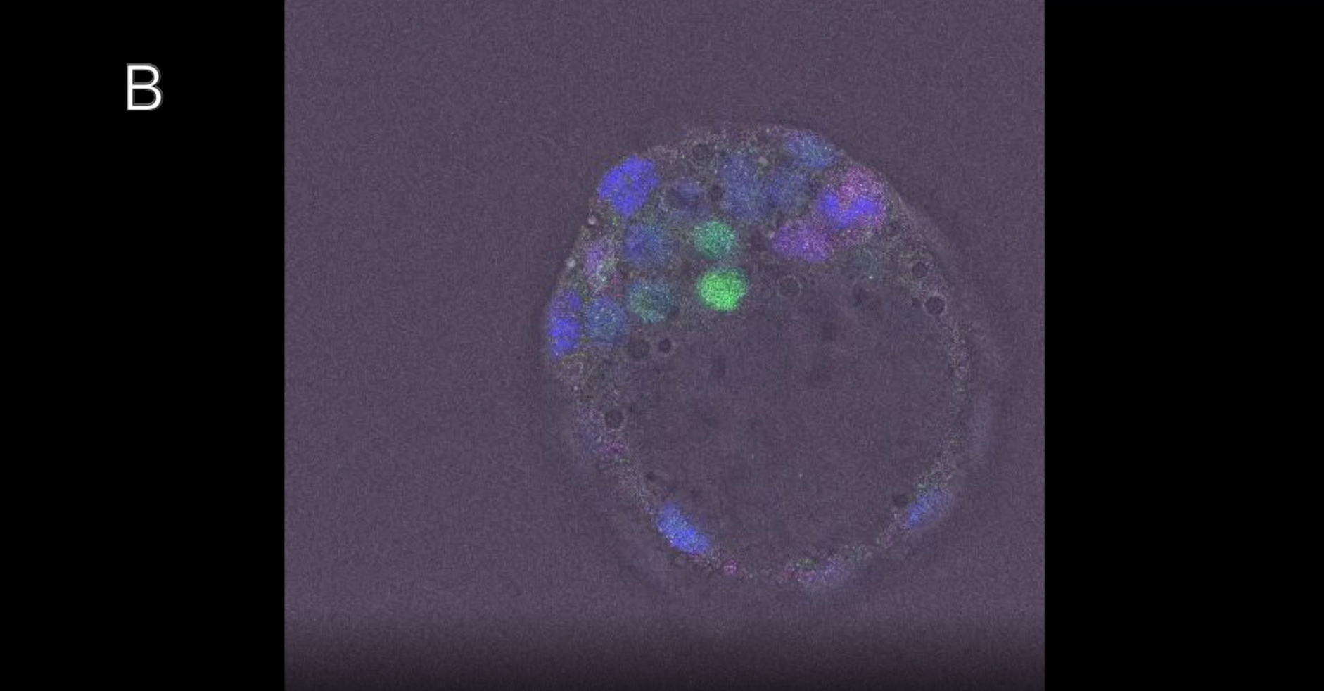siRNA-treated ES cells 