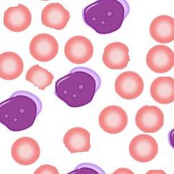 New drug target discovered for acute myeloid leukaemia