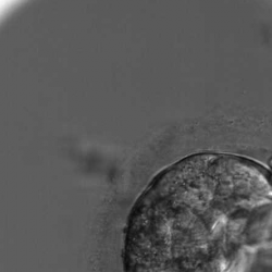 Genome editing reveals role of gene important for human embryo development