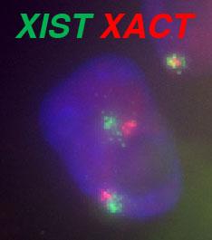 Understanding X-chromosome silencing in humans