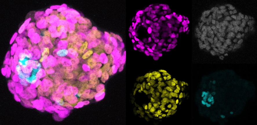 A cell aggregation of human pluripotent stem cells and amniotic ectoderm cells. Credit Shota Nakanoh