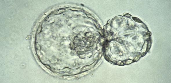 A human embryo at the blastocyst stage, about six days after fertilization, viewed under a light microscope. The embryo is in the process of "hatching" out of the zona pellucida - the tough outer membrane - just before implanting in the wall of the uterus
