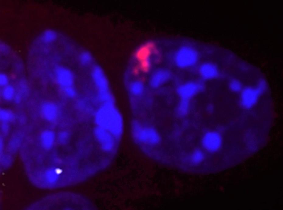 New stem cell research fundamentally changes our understanding of male and female early development 