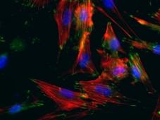 Smooth muscle cells created from patients’ skin cells