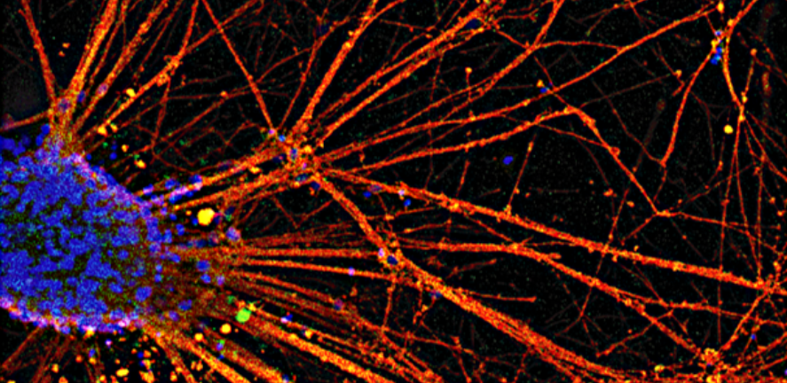 dopaminergic neurons differentiated from human pluripotent stem cells